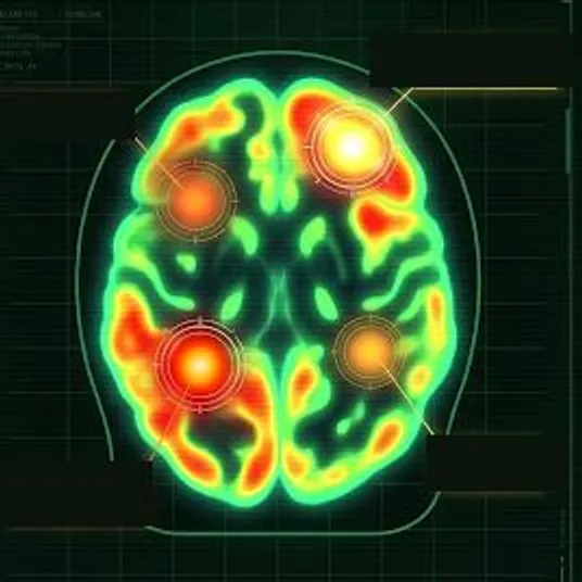 Degen brain thermal scan — glowing hotspots of addiction behaviour